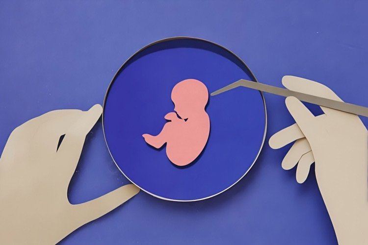 عمل IVF برای درمان ناباروری